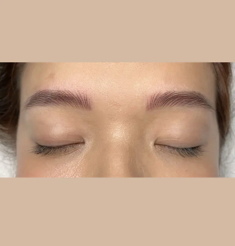 Before image