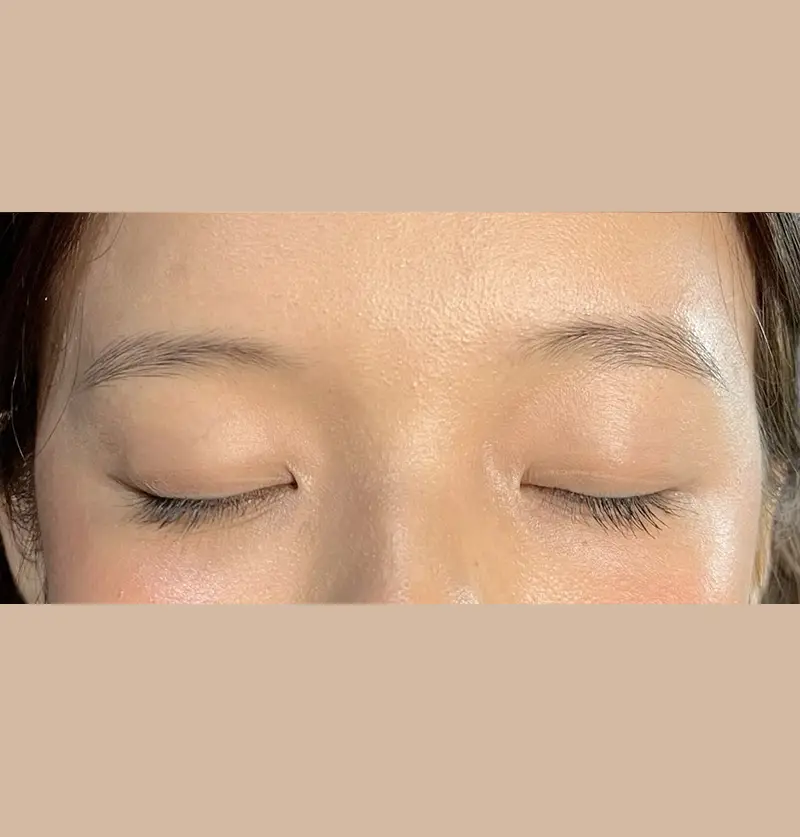 After image